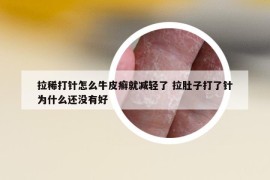 拉稀打针怎么牛皮癣就减轻了 拉肚子打了针为什么还没有好