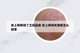 身上痒痒挠了之后起癣 身上痒挠完像癣怎么回事