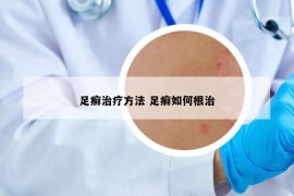 足癣治疗方法 足癣如何根治