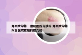 郑州大学第一附属医院皮肤科 郑州大学第一附属医院皮肤科在几楼