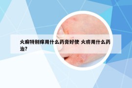 火癣特别痒用什么药膏好使 火疥用什么药 治?