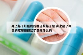 身上起了红色的疙瘩还鼓起了包 身上起了红色的疙瘩还鼓起了包吃什么药