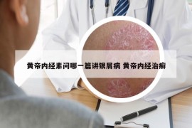 黄帝内经素问哪一篇讲银屑病 黄帝内经治癣