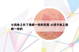 小孩身上长了像癣一样的东西 小孩子身上像癣一样的