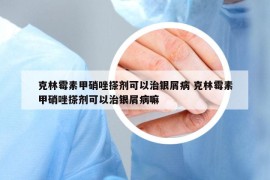 克林霉素甲硝唑搽剂可以治银屑病 克林霉素甲硝唑搽剂可以治银屑病嘛