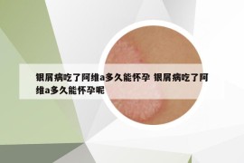 银屑病吃了阿维a多久能怀孕 银屑病吃了阿维a多久能怀孕呢