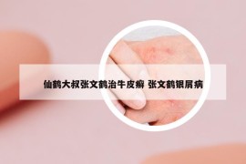 仙鹤大叔张文鹤治牛皮癣 张文鹤银屑病