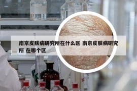 南京皮肤病研究所在什么区 南京皮肤病研究所 在哪个区