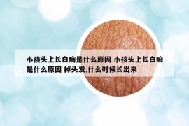 小孩头上长白癣是什么原因 小孩头上长白癣是什么原因 掉头发,什么时候长出来