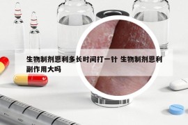 生物制剂恩利多长时间打一针 生物制剂恩利副作用大吗