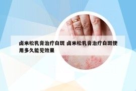 卤米松乳膏治疗白斑 卤米松乳膏治疗白斑使用多久能见效果