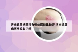 济南银屑病医院有哪些医院比较好 济南银屑病医院改名了吗