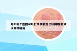 郑州哪个医院可以打生物制剂 郑州哪里有武汉生物疫苗