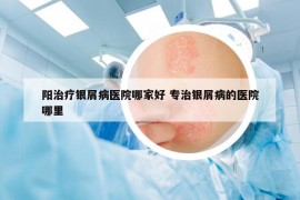 阳治疗银屑病医院哪家好 专治银屑病的医院哪里