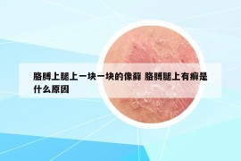 胳膊上腿上一块一块的像藓 胳膊腿上有癣是什么原因