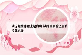 缺乏维生素脸上起白斑 缺维生素脸上有白一片怎么办