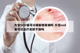 大宝SOD蜜可以缓解银屑病吗 大宝sod蜜可以治疗皮肤干裂吗