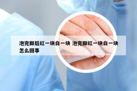 泡完脚后红一块白一块 泡完脚红一块白一块怎么回事