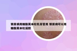 银屑病用糠酸莫米松乳膏管用 银屑病可以用糠酸莫米松凝胶