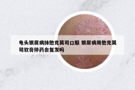 龟头银屑病抹他克莫司口服 银屑病用他克莫司软膏停药会复发吗