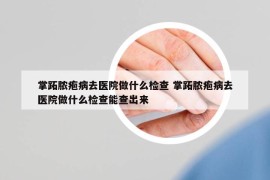 掌跖脓疱病去医院做什么检查 掌跖脓疱病去医院做什么检查能查出来