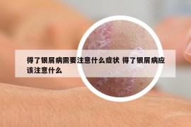 得了银屑病需要注意什么症状 得了银屑病应该注意什么