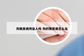 狗银屑病传染人吗 狗的银屑病怎么治