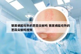 银屑病能吃熟的葱蒜尖椒吗 银屑病能吃熟的葱蒜尖椒吗视频