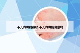 小儿白斑的症状 小儿白斑能自愈吗