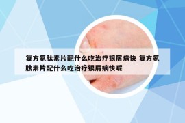 复方氨肽素片配什么吃治疗银屑病快 复方氨肽素片配什么吃治疗银屑病快呢