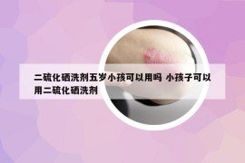 二硫化硒洗剂五岁小孩可以用吗 小孩子可以用二硫化硒洗剂