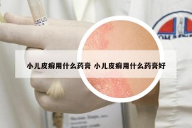 小儿皮癣用什么药膏 小儿皮癣用什么药膏好