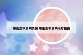 脓疱型银屑病美国 脓疱型银屑病治疗指南