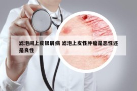 滤泡间上皮银屑病 滤泡上皮性肿瘤是恶性还是良性