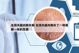 女孩大腿内侧长癣 女孩大腿内侧长了一块像癣一样的东西