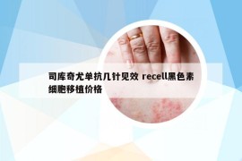 司库奇尤单抗几针见效 recell黑色素细胞移植价格