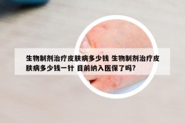 生物制剂治疗皮肤病多少钱 生物制剂治疗皮肤病多少钱一针 目前纳入医保了吗?