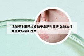 沈阳哪个医院治疗孩子皮肤科最好 沈阳治疗儿童皮肤病的医院