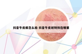 抖音牛皮癣怎么拍 抖音牛皮纸特效在哪里