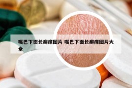 嘴巴下面长癣痒图片 嘴巴下面长癣痒图片大全