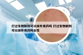 打过生物制剂可以抹外用药吗 打过生物制剂可以抹外用药吗女性