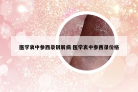 医学衷中参西录银屑病 医学衷中参西录价格