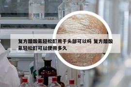 复方醋酸氟轻松酊用于头部可以吗 复方醋酸氟轻松酊可以使用多久