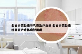 曲安奈德益康唑乳膏治疗皮癣 曲安奈德益康唑乳膏治疗体癣管用吗