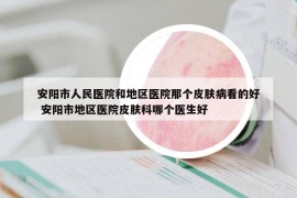 安阳市人民医院和地区医院那个皮肤病看的好 安阳市地区医院皮肤科哪个医生好