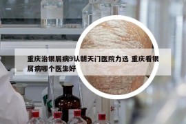 重庆治银屑病9认朝天门医院力选 重庆看银屑病哪个医生好