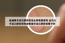 金迪银卡泊三醇软膏怎么样有激素吗 达力士卡泊三醇软膏和金银迪卡泊三醇软膏那个好