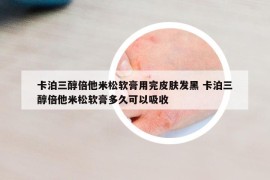 卡泊三醇倍他米松软膏用完皮肤发黑 卡泊三醇倍他米松软膏多久可以吸收