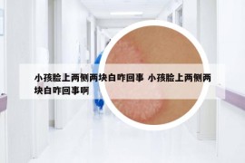 小孩脸上两侧两块白咋回事 小孩脸上两侧两块白咋回事啊