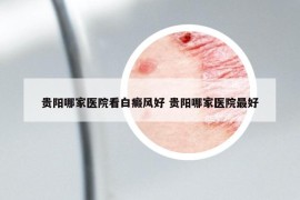 贵阳哪家医院看白癜风好 贵阳哪家医院最好